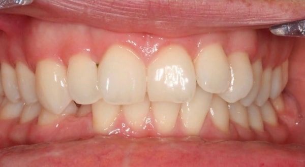 Before - Campden House Dental