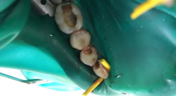 Before - Campden House Dental