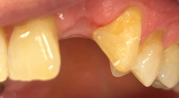 Before - Campden House Dental