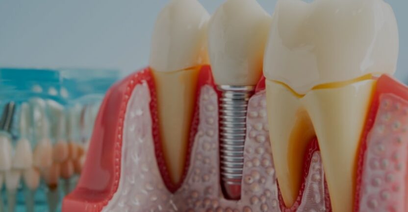 Treatments - Campden House Dental