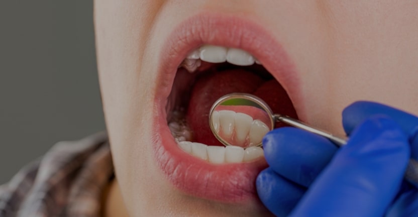 Treatments - Campden House Dental