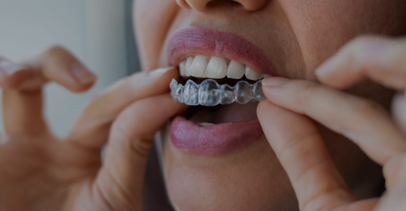 Treatments - Campden House Dental