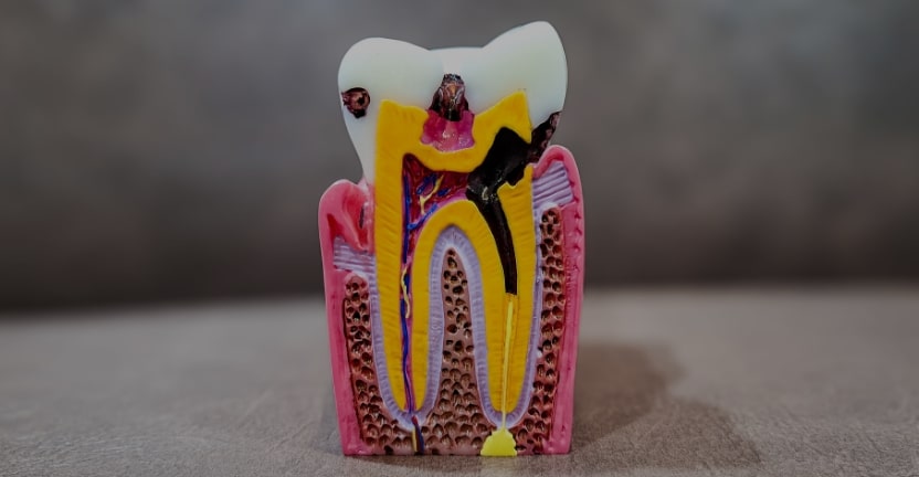 Treatments - Campden House Dental